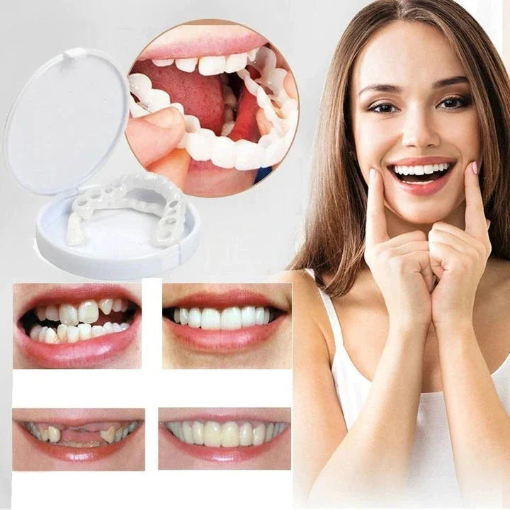 Cosmetische Boven‑ en Onderbitjes met Directe Natuurlijke Look