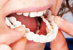 FitFlex Opzetgebit Met Natuurlijke Glimlach